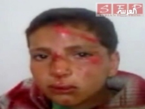 A child from Daraa was tortured by Assad regime