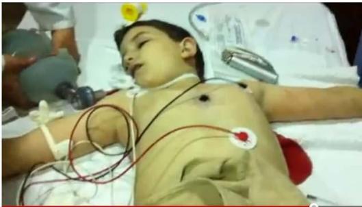 Ibrahim Alsheibany, 10 YO, was shot by a sniper in Damascus